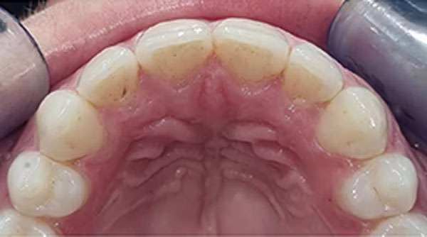 Ortho-Case-25-A