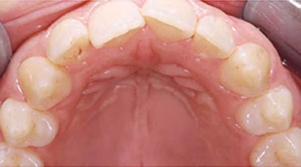 Ortho-Case-25-B