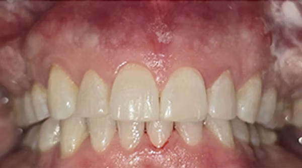 Ortho Case 3 A