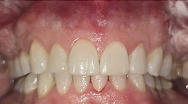 Ortho Case 3 A