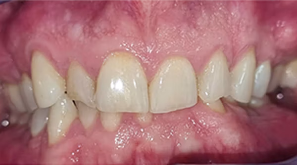 Ortho Case 3 B