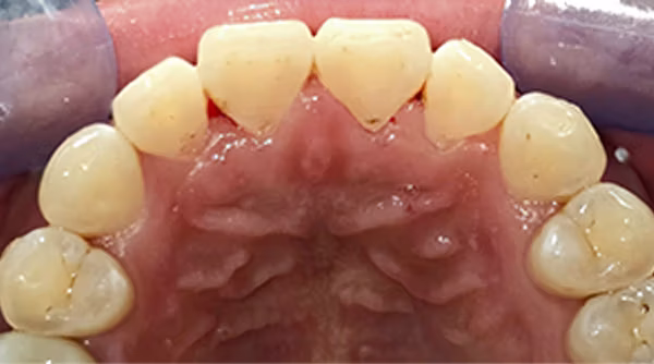 Ortho Case 4 A