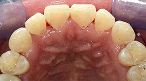 Ortho Case 4 A