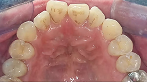 Ortho Case 4 B