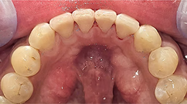 Ortho Case 5 A