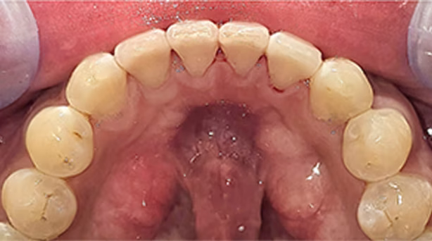 Ortho Case 5 A
