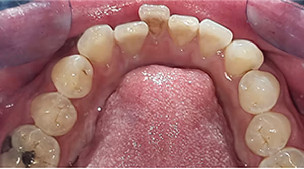 Ortho Case 5 B
