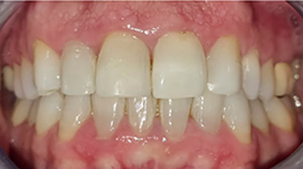 Ortho Case 6 A