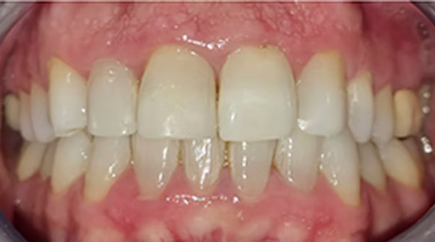 Ortho Case 6 A