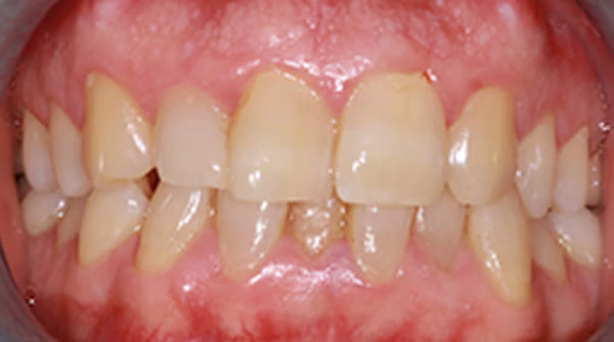 Ortho Case 6 B