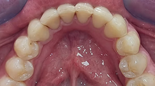 Ortho Case 7 A