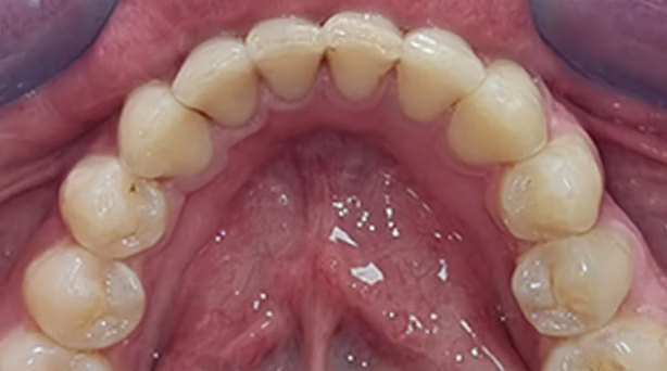 Ortho Case 7 A