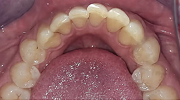 Ortho Case 7 B