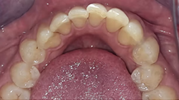 Ortho Case 7 B
