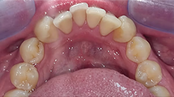 Ortho Case 8 B