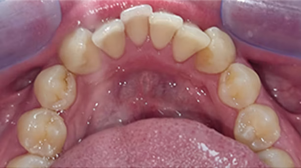 Ortho Case 8 B