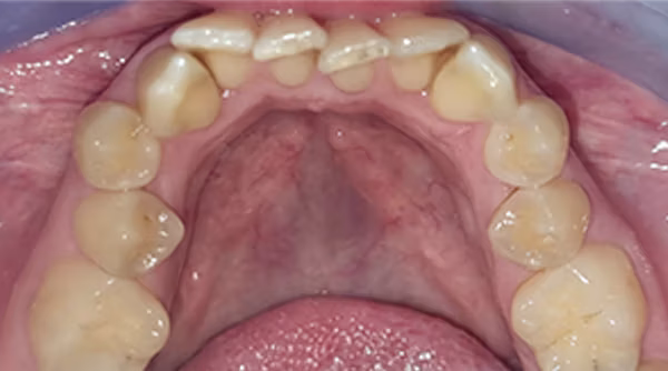 Ortho Case 9 B